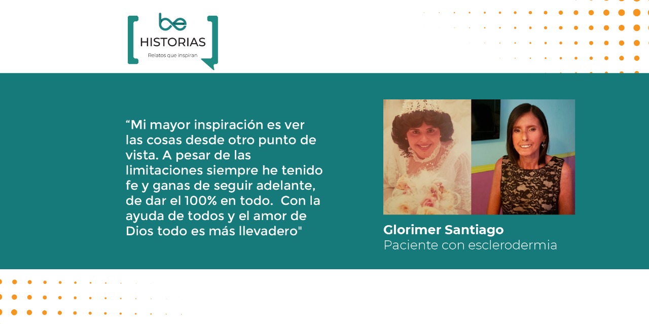 Veinticinco años viviendo con esclerodermia: la historia de Glorimer