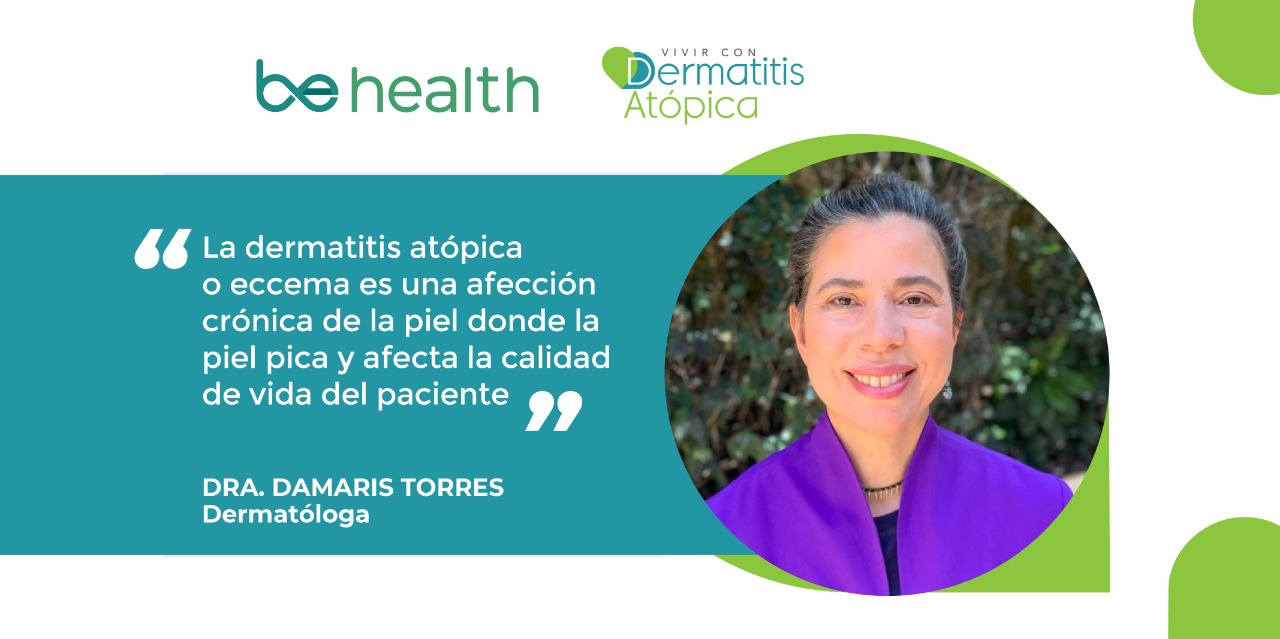 Eccema o dermatitis atópica