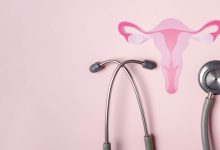 Según la Organización Mundial de la Salud (OMS), La endometriosis afecta aproximadamente a 190 millones de mujeres y niñas en edad reproductiva en todo el mundo, es decir, a cerca del 10 % de este grupo poblacional.