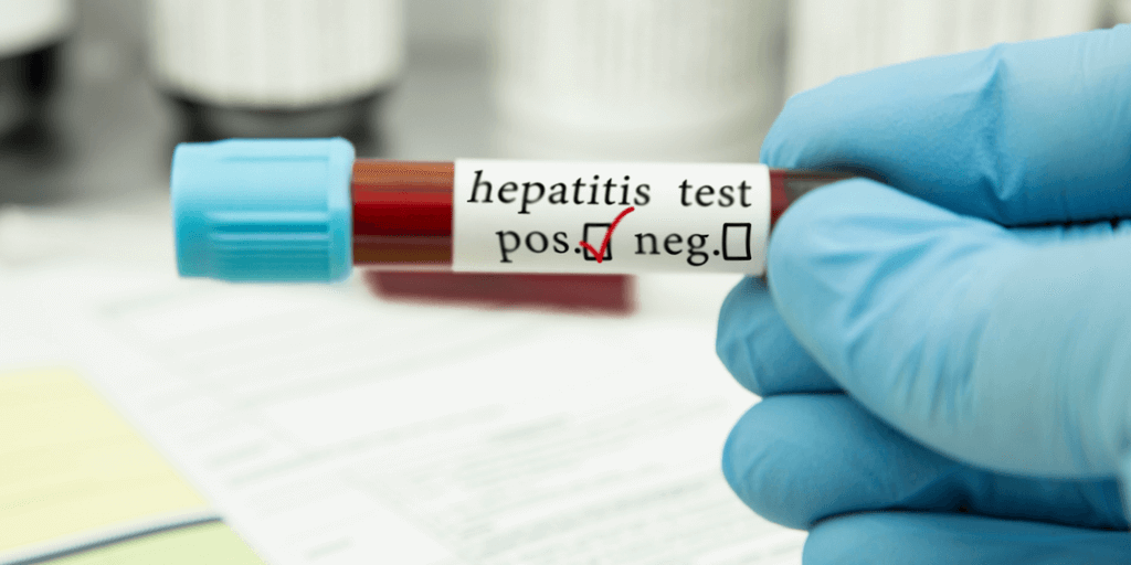 Hepatitis