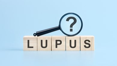 Los síntomas del lupus, al igual que en muchas enfermedades autoinmunes, tienden a ser intermitentes.