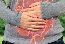 Pacientes con síntomas de enfermedades inflamatorias intestinales a menudo enfrentan largas esperas para obtener un diagnóstico definitivo.