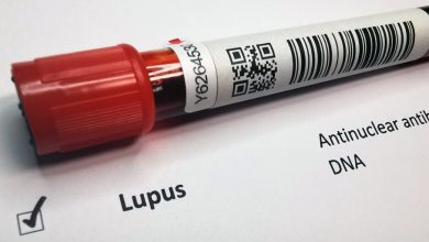 Este avance representa una esperanza renovada para quienes viven con lupus, sugiriendo que estamos un paso más cerca de entender y tratar esta compleja enfermedad.