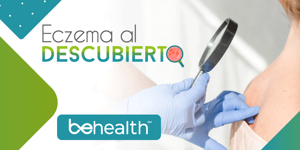 imagen destacada perteneciente al eczema al descubierto