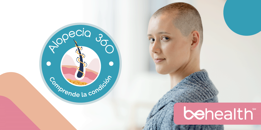 imagen destacada perteneciente a la alopecia