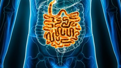 Opciones de Tratamiento para Enfermedades Inflamatorias Intestinales (EII)