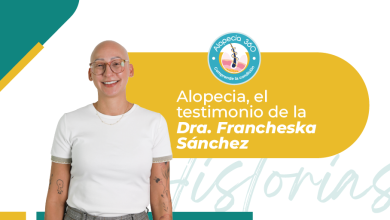 Descubre la historia de Francheska Sánchez, psicóloga y paciente de alopecia areata, quien comparte su experiencia con esta condición autoinmune.