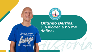 Historia Orlando Berríos y su lucha con alopecia