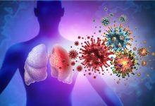 Diferencia entre VRS, influenza y COVID-19