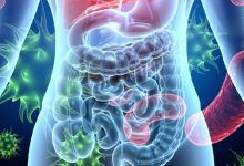 Desequilibrio intestinal, las enfermedades más comunes relacionadas con el problema