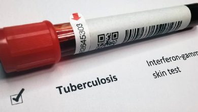 Tuberculosis, una infección en alarma