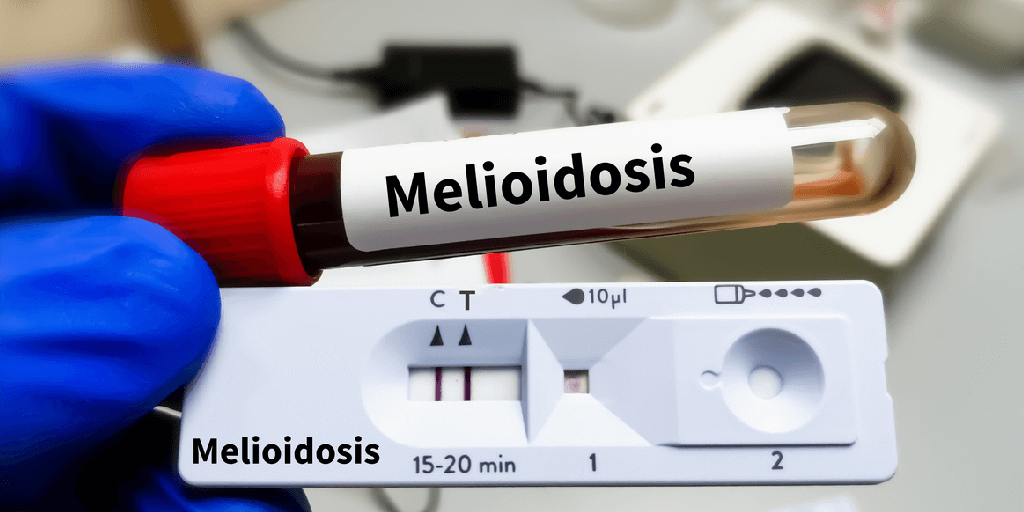 Melioidosis