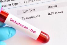 Testosterona en las mujeres