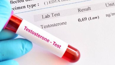 Testosterona en las mujeres