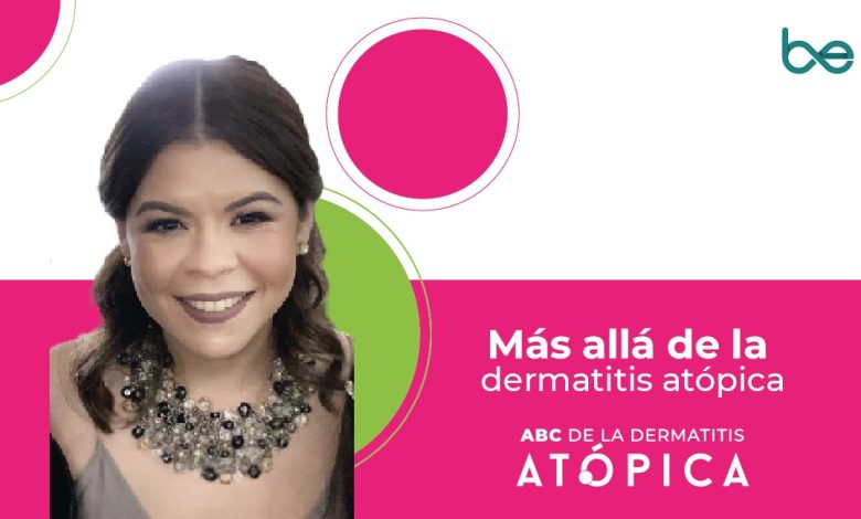 Más allá de la dermatitis atópica - Kiara